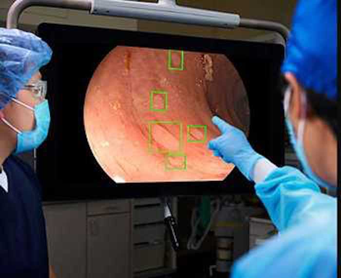 New Colon Cancer Technology at StoneCrest