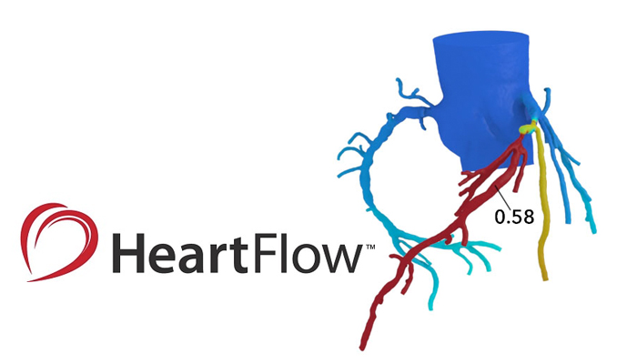 HeartFlow