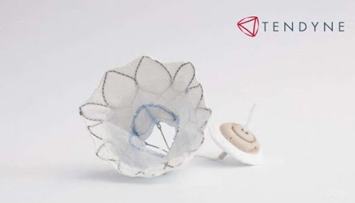 Tendyne mitral valve replacement