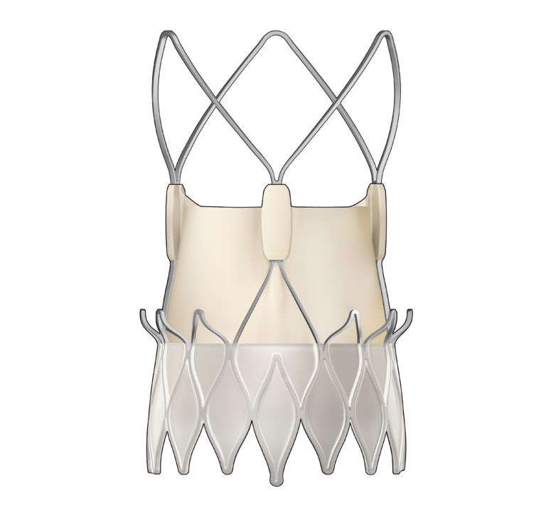 ASCENSION SAINT THOMAS FIRST IN TENNESSEE TO IMPLANT HEART INNOVATION