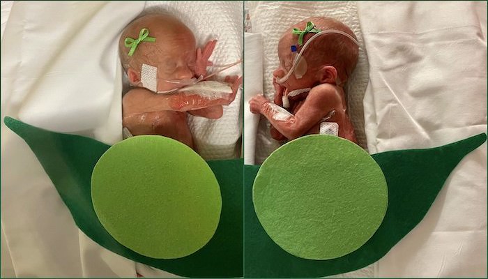 Ascension Saint Thomas Hospital’s Heartwarming NICU Halloween Tradition Continues